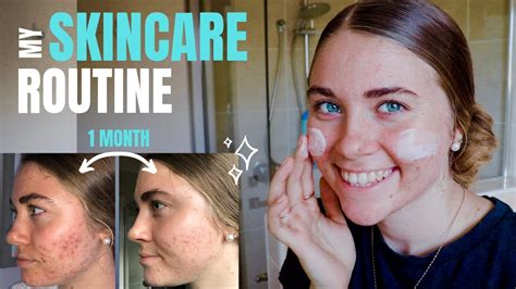 My Current Skincare Routine Healing Acne And Acne Scarring Youtube