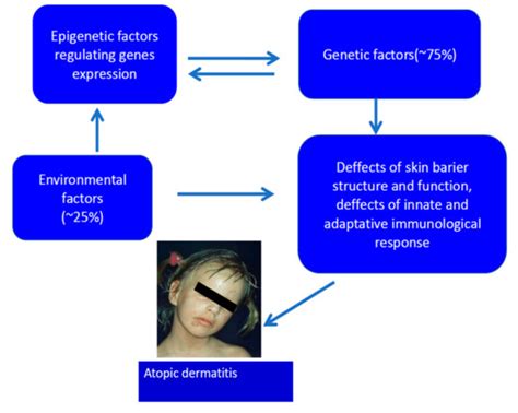 Ijms Free Full Text Genetic And Epigenetic Aspects Of Atopic Dermatitis