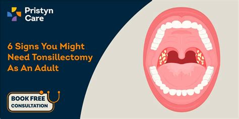 Signs You Might Need A Tonsillectomy As An Adult Pristyn Care