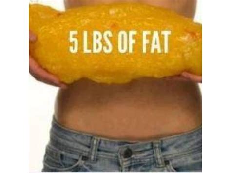 This Is The Reality Of What 5 Lbs Of Fat Isimagine If Your 10 20