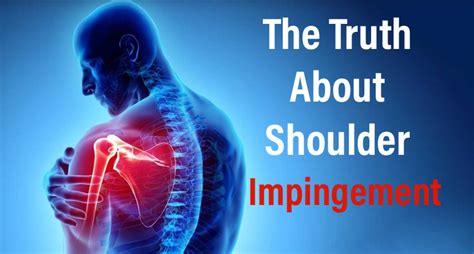 The Truth About Shoulder Impingement Spectrum Physical Therapy