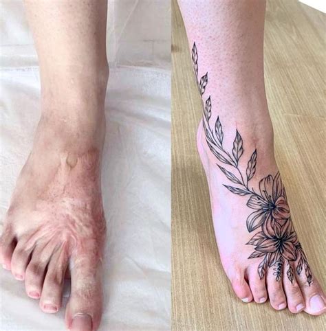 Tattoos Can Help You Turn Scars Into Something Beautiful