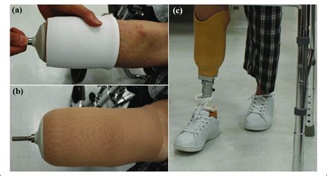 Donning Of Prosthesis A The Silicone Liner Was Rolled Up The Stump