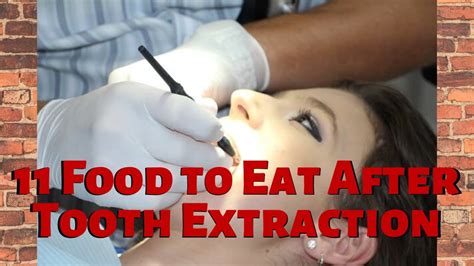 11 Food To Eat After Tooth Extraction Healthy Eating Youtube