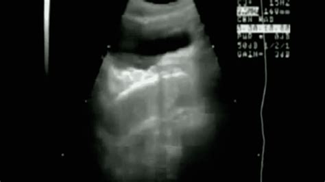 What Sex Looks Like In 4d Ultrasound Iflscience