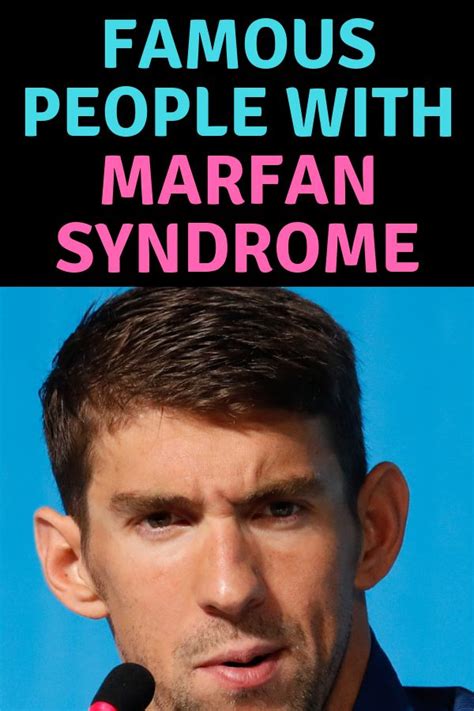 17 Famous People With Klinefelter Syndrome Or Marfan Syndrome