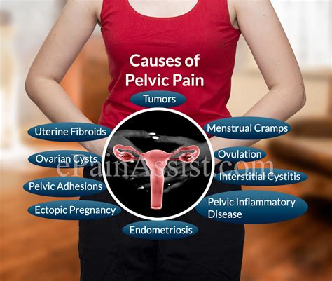 Causes Of Pelvic Pain In Females