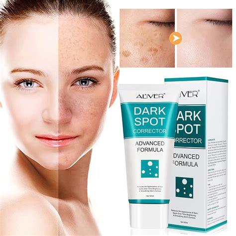 Buy Dark Spot Remover For Face Dark Spot Corrector Cream Fade Out The