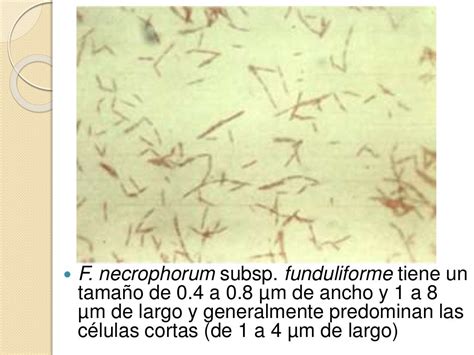 Fusobacterium Necrophorum