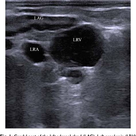 Figure 1 From Transrectal Ultrasonography Of The Adrenal Glands In