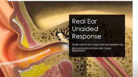Real Ear Measurement And Speech Mapping With Ms Amy Lennox Youtube