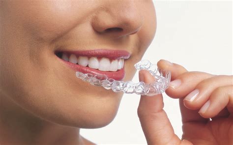What Is Invisalign And How Does It Move Teeth Part 1 Jorgensen Orthodontics Affordable Care