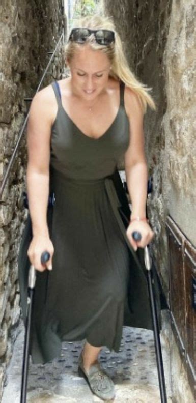 Love This Dress And Crutches She Is Really Enjoying Her First Holiday As A One Legged Woman