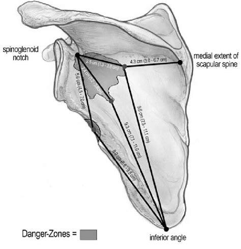 A Normalized Scapula With Pertinent Bony Landmarks Black Dots Was