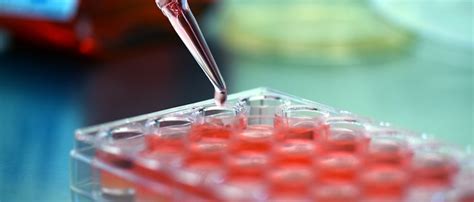 Growth of animal cells in culture. Analysis Of Cell Culture Market In Global Industry: Demand ...