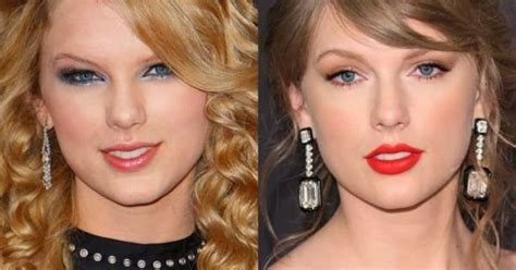 Taylor Swift Then And Now Swifts Plastic Surgery Rumors Explored