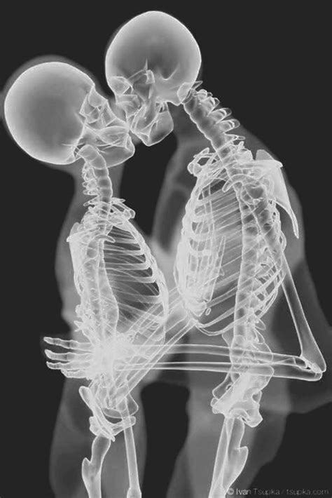 X Ray Kiss Green Aesthetic Dark Green Aesthetic Xray Art