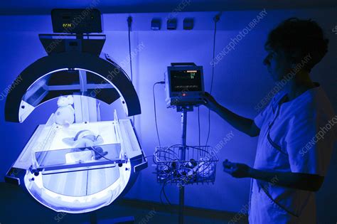 Neonatal Jaundice Phototherapy Stock Image C0063709 Science