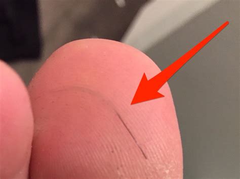 Video Shows Hair Removal From The Bottom Of The Big Toe