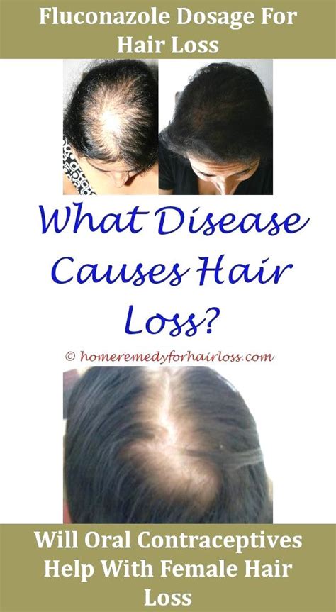 Some women after child birth or during approach of. Homeopathic #Remedy For Hair Loss In Females,Hair Loss ...