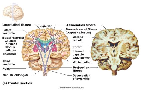 There Are 3 Main Types Of Tracts Located In The White Matter Of The