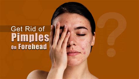 How To Get Rid Of Bumps On Forehead Health For Best Life
