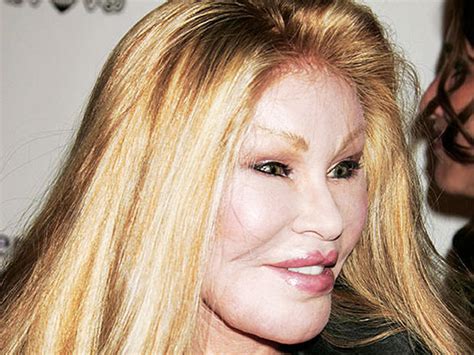 Celebrity Plastic Surgery Disasters? - Photo 1 - Pictures ...