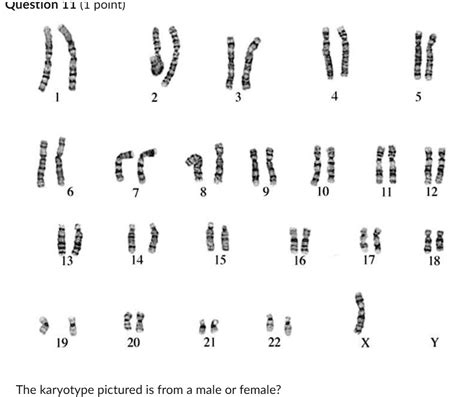 Solved A Male B Female What Is Abnormal About This Karyotype A Missing A Sex Chromosome