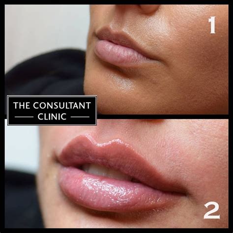 See This Instagram Photo By Consultantclinic • 243 Likes Clinic