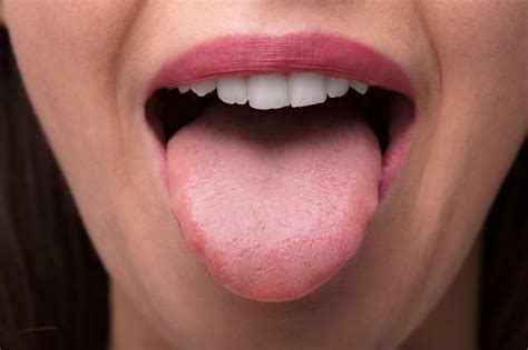 Dentist How And Why You Should Clean Your Tongue Dr Jacob Milner