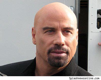 Einzigartig John Travolta Haare Transplantiert Bild