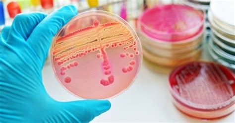 Microbiologia Resumo O Que é E Microrganismos Toda Matéria