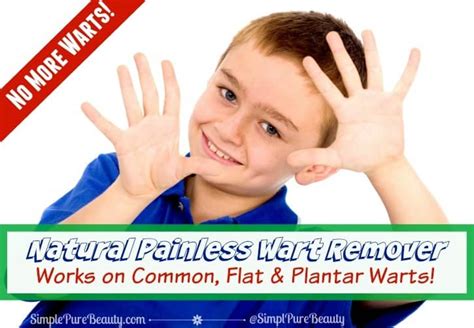 Natural Painless Wart Removal Safe For Kids And Flat Warts On Face