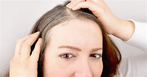 What Causes Premature Grey Hair At Young Age Reasons