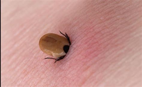 Mid Atlantic Becomes Tick Central As Species From North