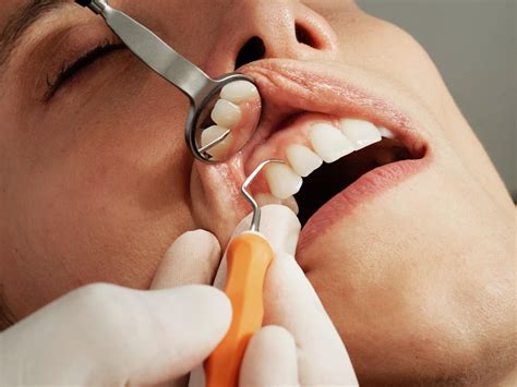 a comprehensive guide to tooth sensitivity