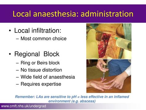 Ppt Suturing Powerpoint Presentation Free Download Id3096480