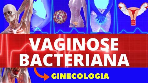 VAGINOSE BACTERIANA CAUSAS SINTOMAS E TRATAMENTO GINECOLOGIA