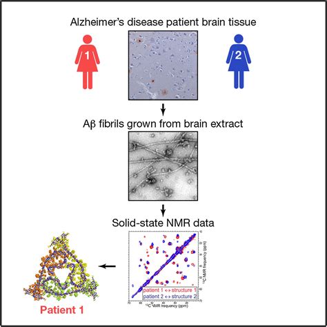 Molecular Structure Of β Amyloid Fibrils In Alzheimers Disease Brain