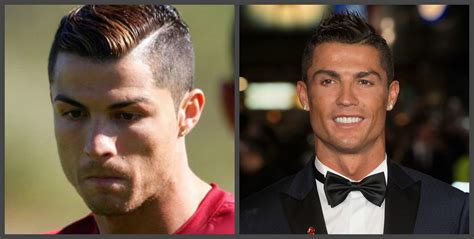 Cristiano Ronaldo Teeth Before And After A Selection Of Photos