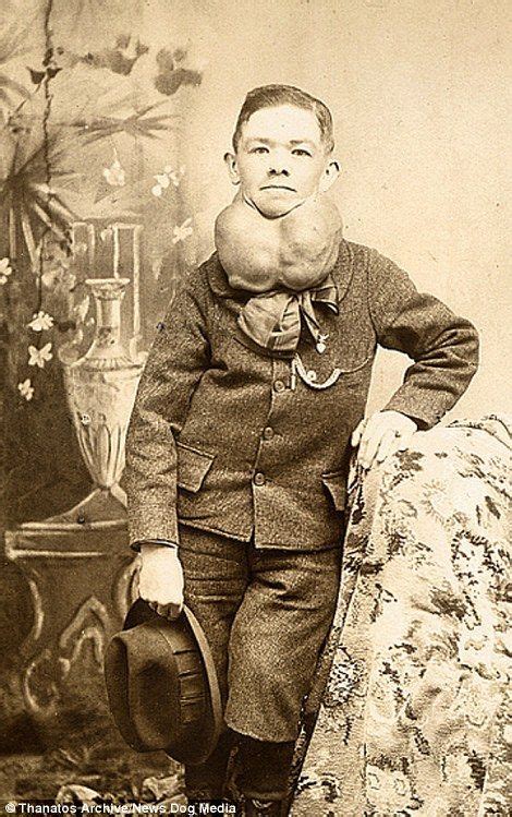 Captivating Collection Of 19th Century Deformities