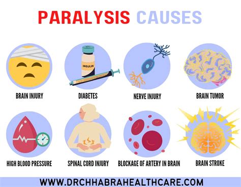 Paralysis Symptoms Treatment And Causes Dr Chhabra