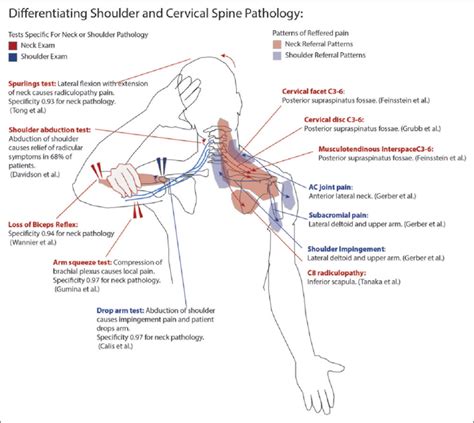 Pain Referral Patterns For The Shoulder And Neck And Using Examination