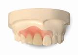 Pictures of Valplast Denture Repair