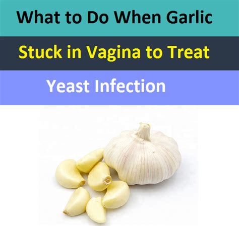 What To Do When Garlic Stuck In Vagina To Treat Yeast Infection