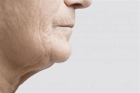Jowls Exercises Causes Treatment And Prevention
