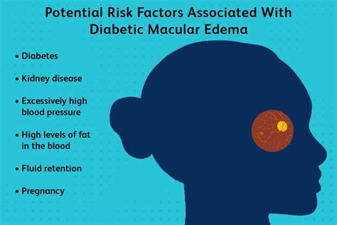 Diabetic Macular Edema Types Symptoms Treatment