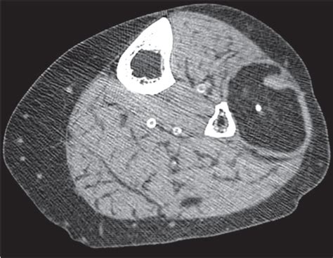 11 Soft Tissue Disease Radiology Key