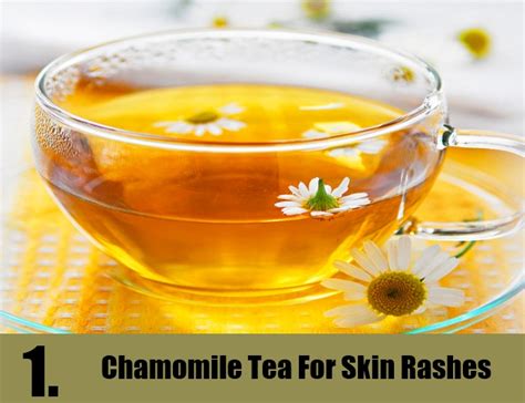 The Many Benefits Of Chamomile Tea For Skin Rashes Just Tea