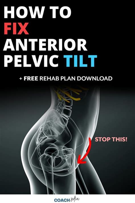8 Exercises To Fix Anterior Pelvic Tilt Pdf Plan Included Coach